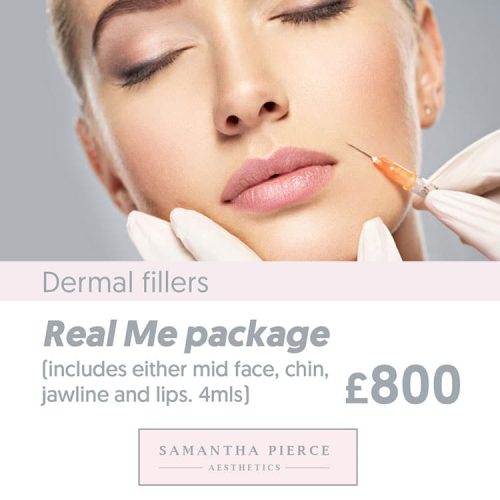 SPA---Derma-fillers-social-posts-V1-1